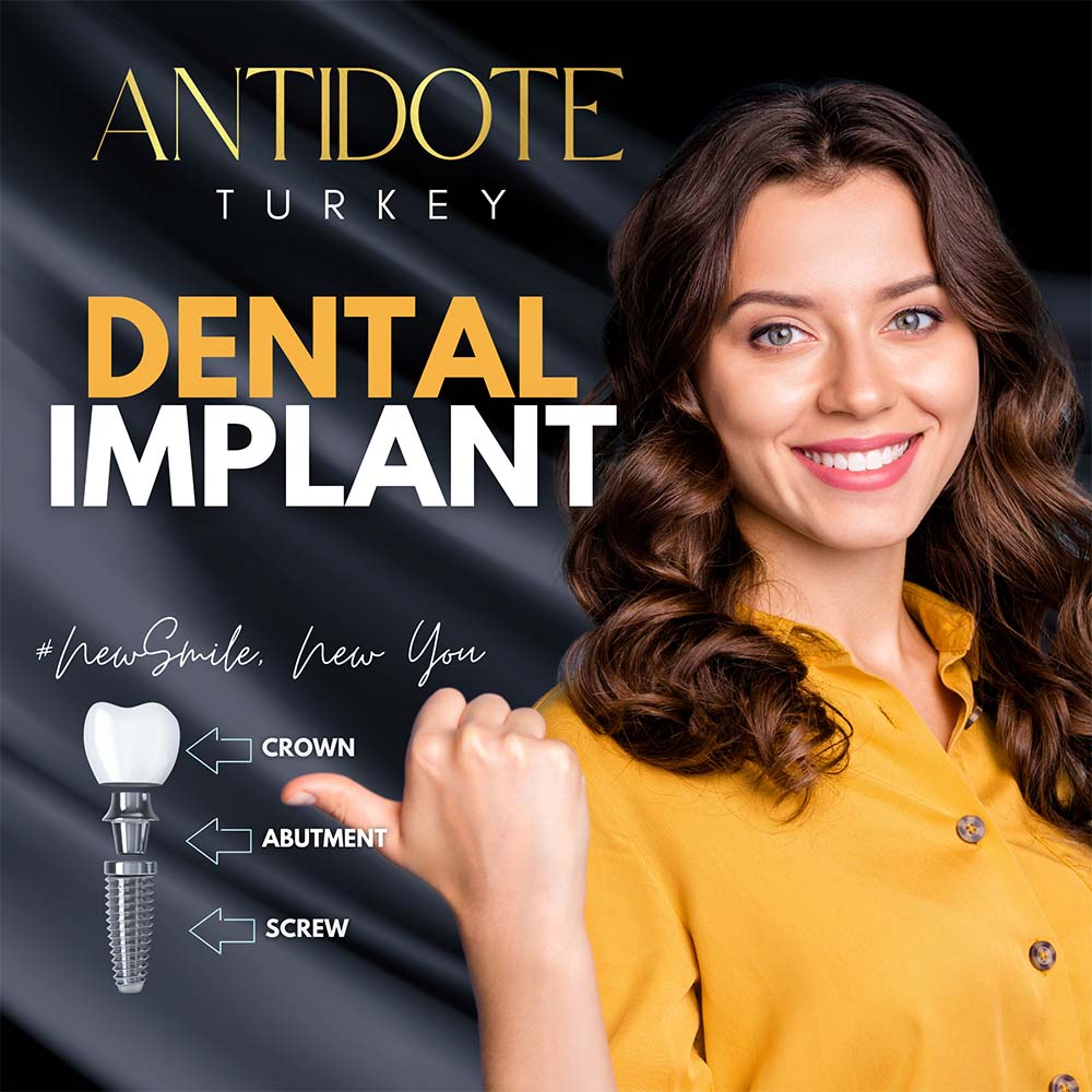 Dental Implant - 1